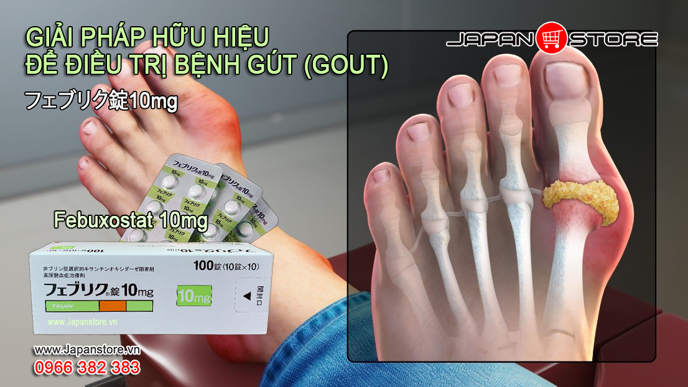 Thuốc Gout (Gút) Nhật Bản Feburic 10mg (Febuxostat 10mg) -Japanstore_vn2